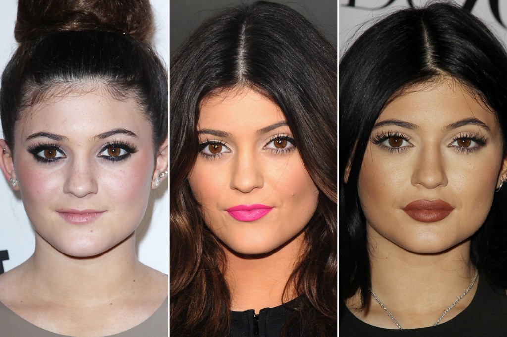 kylie-jenner-lips