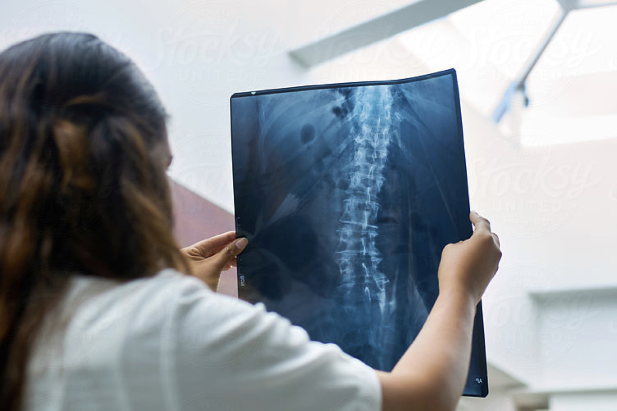 Back Pain - Lumber Spine x-ray